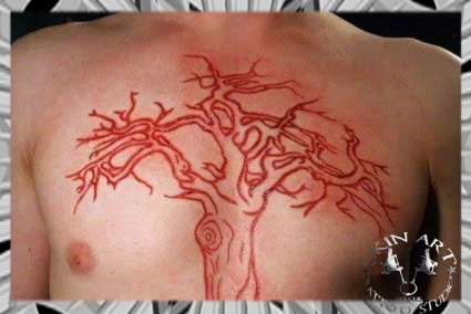 Scarification